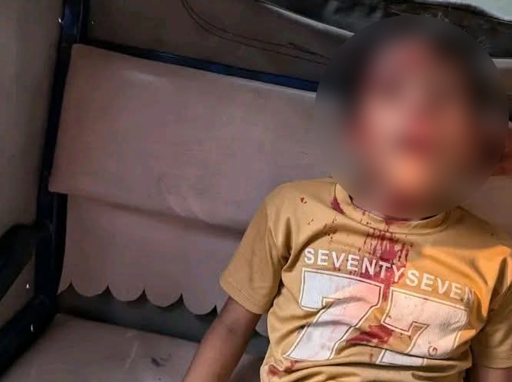 আড়াইহাজারে শিয়ালের আক্রমণে শিশুসহ চারজন আহত