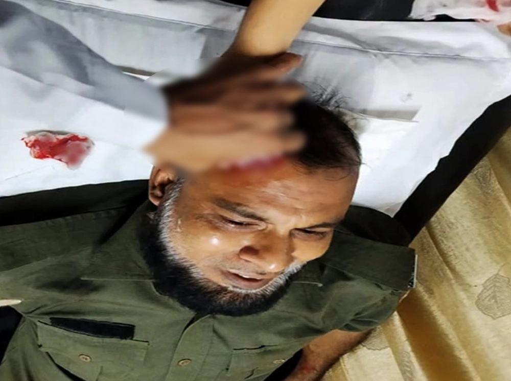 ডিইপিজেডে উচ্ছেদ অভিযানে হকারদের হামলায় আনসার সদস্য আহত