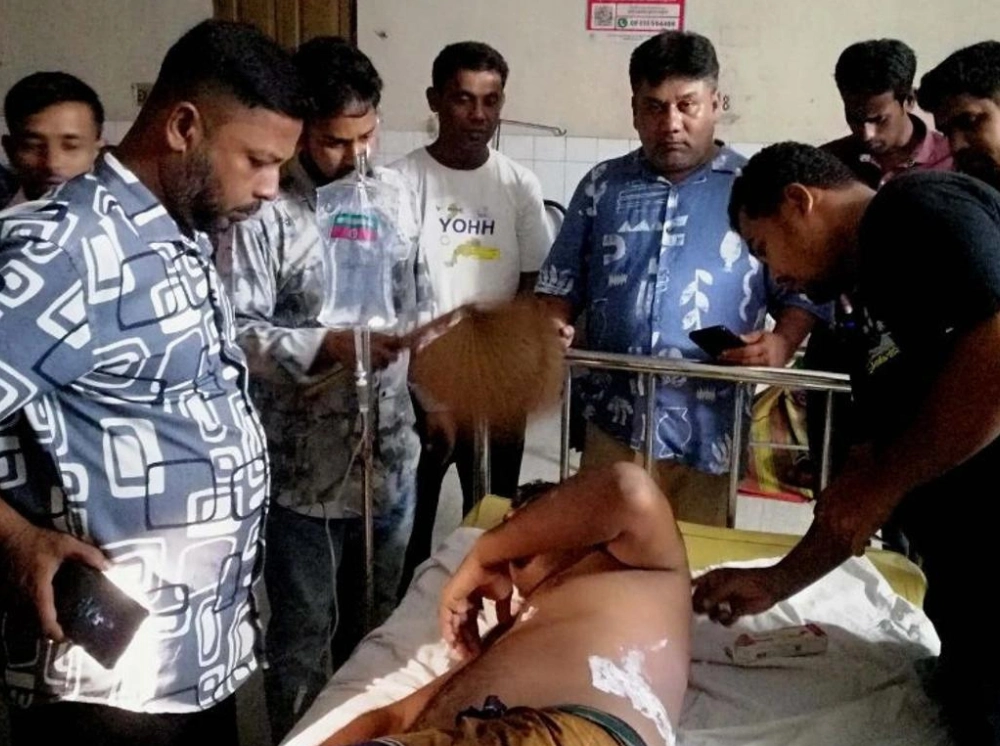 ছাত্রদল নেতার শরীরে গরম পানি ঢেলে ঝলসে দিল আ.লীগ নেতার ছেলে