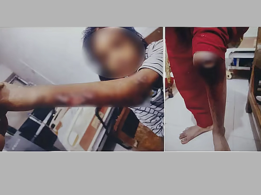 বেরিয়ে এলো বিমানের সাবেক এমডির বাসার গৃহকর্মী নির্যাতনের লোমহর্ষক বর্ণনা