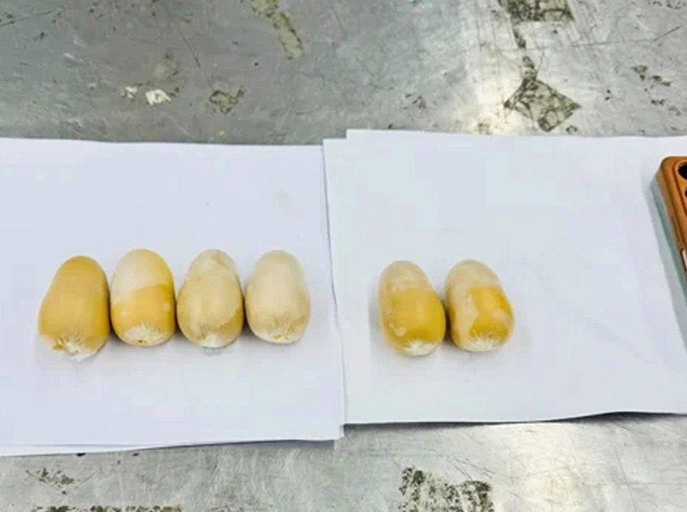 দুই যাত্রীর পায়ুপথে মিলল ৬ ‘স্বর্ণের ডিম’