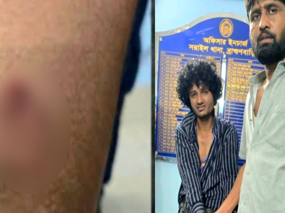 মাদক কারবারির কামড়ে আহত দুই পুলিশ, আটক ১